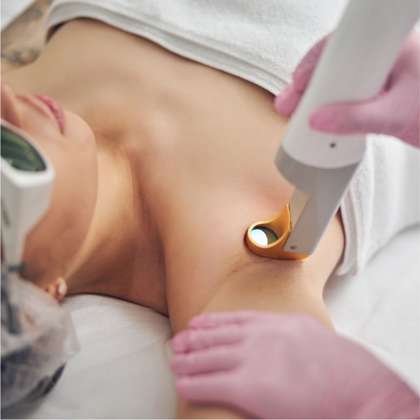 laser_hair_removal2
